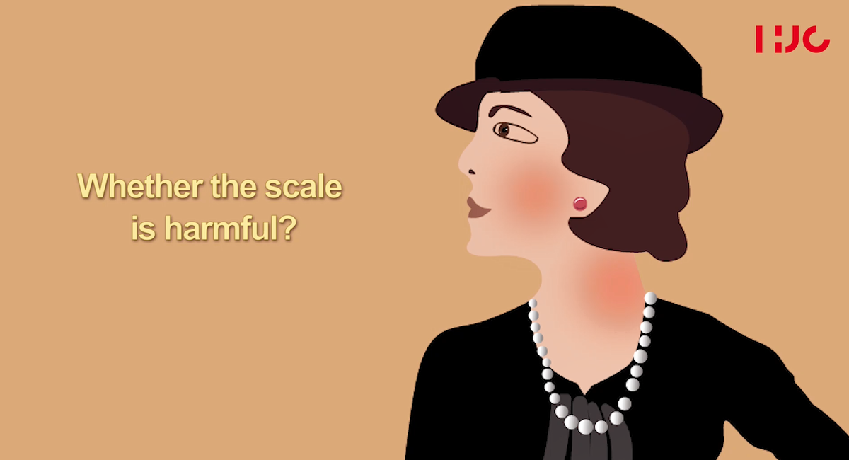 Whether the scale is harmful?